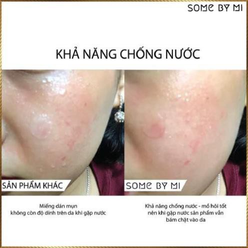 Miếng dán mụn Some By Mi Acnes Clear Patch gói 18 miếng SAC8