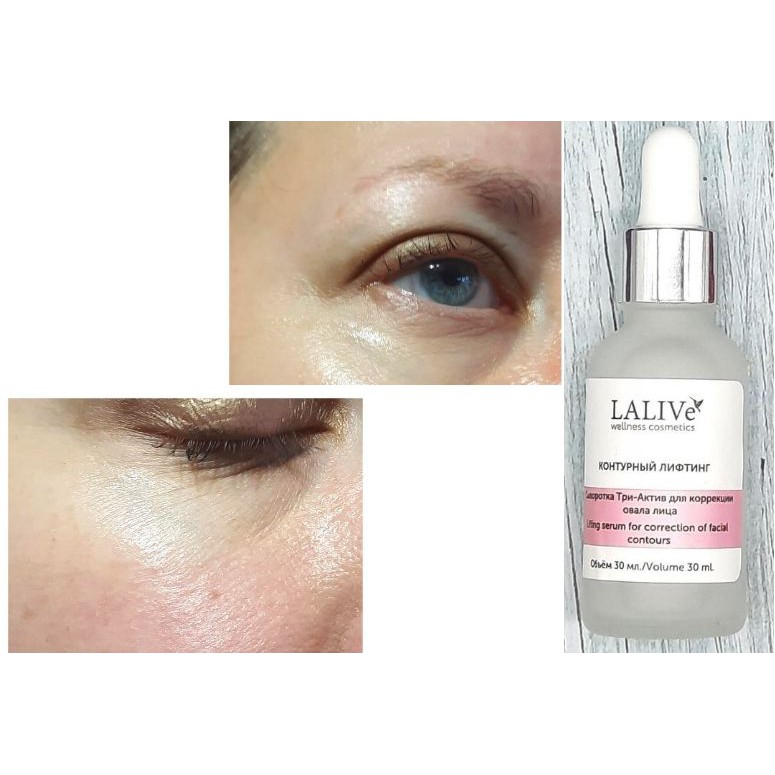 (SPA)Serum tươi LALIVE wellness nâng cơ xóa nhăn, định hình đường nét khuôn mặt, chống chảy sệ da | BigBuy360 - bigbuy360.vn