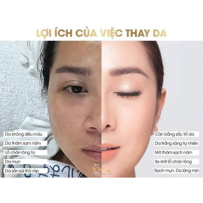 TÁI TẠO VÀ PHỤC HỒI DA YHL[CHÍNH HÃNG SX TẠI HÀN QUỐC]