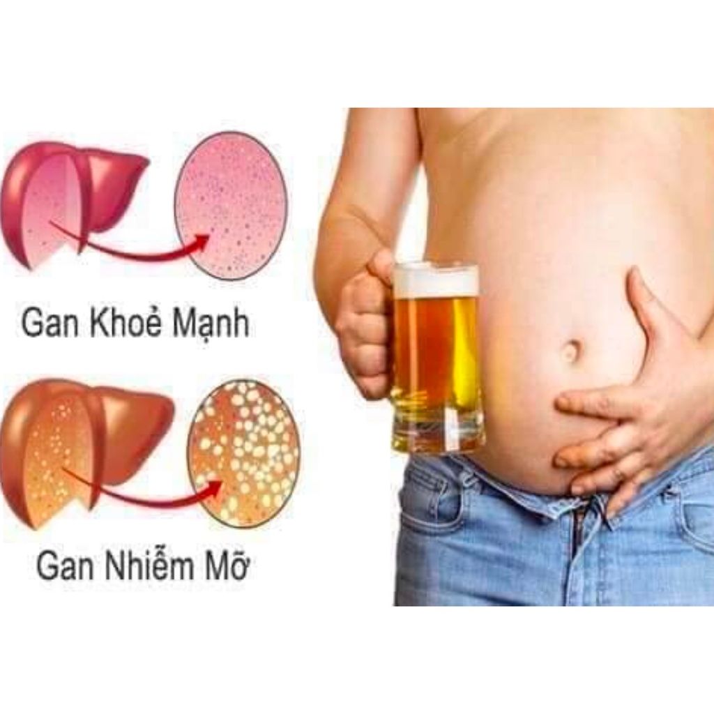 Thuốc bổ gan llyang Parma Hàn Quốc - hỗ trợ viên gan cấp và mãn tính