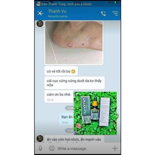 Serum Nunamin 15ML -  da Mụn cóc, Mụn cơm, Mắt cá chân, Chai chân, Mụn thịt, Mụn ruồi