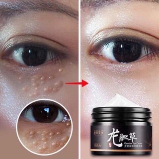 Cao bôi mụn thịt mụn cóc
