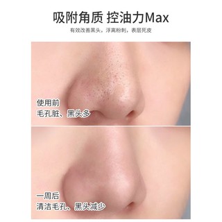 MẶT NẠ ĐẤT SÉT TRẮNG