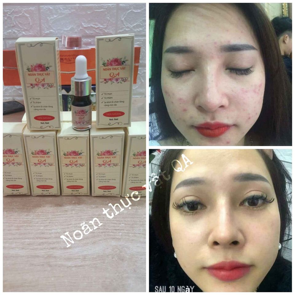 Noãn thực vật QA Beauty loại chuyên cho spa