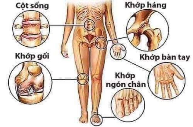 (chính hãng 100%( Tặng hạt chia ) DẦU XOA BÓP THẢO DƯỢC XUÂN VINH(mua 2 chai tặng 1 đầm)