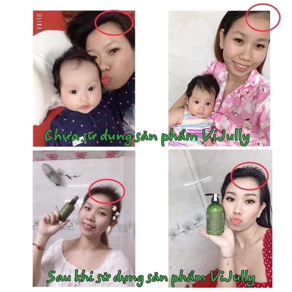 Tinh dầu bưởi Vijully giảm rụng tóc, kích tóc mọc nhanh | BigBuy360 - bigbuy360.vn