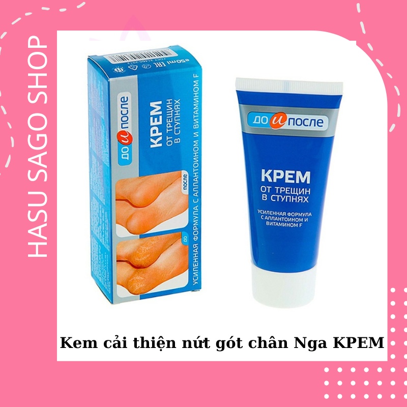 Kem cải thiện nứt gót chân Nga KPEM - loại bỏ nứt gót, làm mềm