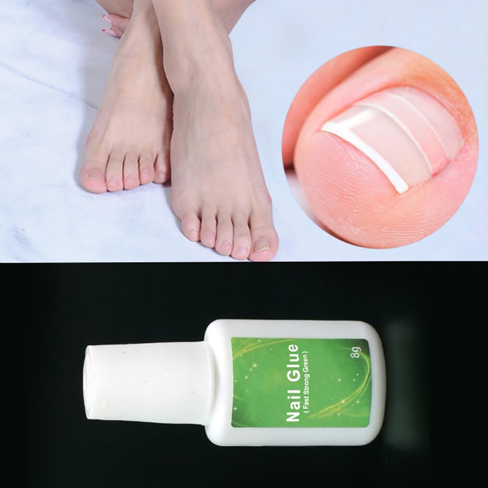 Keo dán điều chỉnh móng chân chuyên dụng 8g