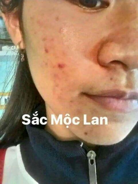 Combo Sắc Mộc Lan