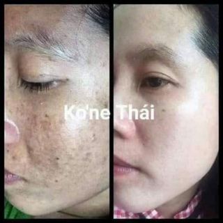 Kem kone thái chính hãng
