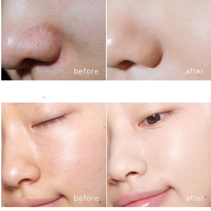 RNW Mặt nạ đất sét hai màu trắng đen làm sạch sâu lỗ chân lông Hỗ trợ giảm mụn 100g