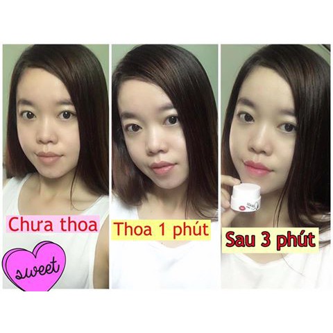 Ủ Hồng Môi, Hồng Ti Queen [TẶNG KÈM BĂNG ĐÔ TAI MÈO]. | BigBuy360 - bigbuy360.vn