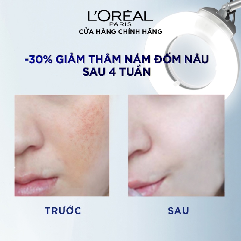 Bộ kem ngày đêm dưỡng trắng da mờ thâm nám Aura Perfect Clinical 50mlx2 &amp; kem chống nắng bảo vệ UV Defender 15ml &amp; Tẩy t