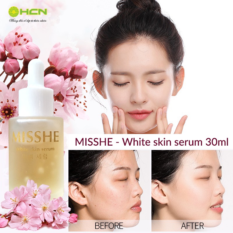 Serum dưỡng trắng MISSHE chiết xuất hoàn toàn từ thiên nhiên - DT061