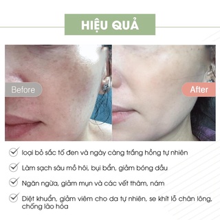 (Combo 2 hũ) Kem Face Pháp Acosmetics Mẫu Mới [Hàng Chính Hãng]