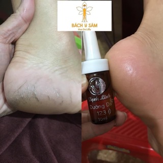 DƯỠNG 123  BÁCH Y SÂM - BẠCH LINH