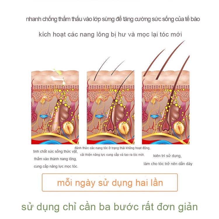 Tinh dầu mọc tóc nhanh,dau dưỡng tóc,serum mọc tóc,ngăn ngừa rụng tóc hair oil grow 30ml kích mọc tóc | BigBuy360 - bigbuy360.vn