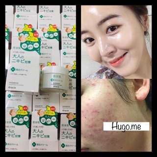 Kem trị mụn trắng da kracie hadabisei nhật bản