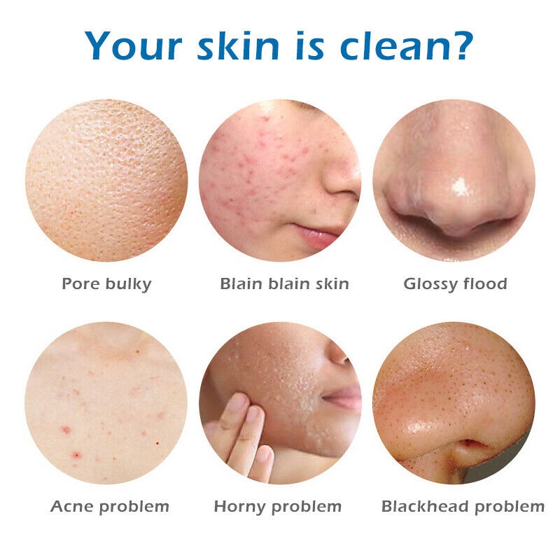 100g Xà Phòng Rửa Mặt Làm Trắng Da