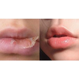 Kem dưỡng môi Cosmetex Roland Loshi Horse Oil Lip Cream 10g - KONNI39 SƠN HÒA