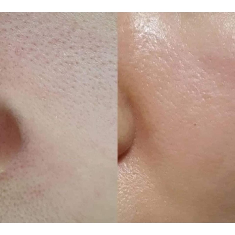 Serum Niacinamide 20% của Derma Factory