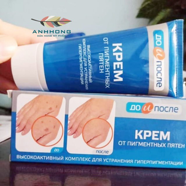 Kem dưỡng da tay trị đồi mồi KPEM 50ml