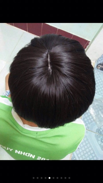 Tóc giả che hói đỉnh đầu- mẫu có đưỡng rãnh da đầu