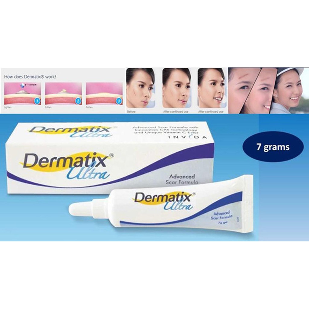 Gel Làm Lành, Mờ Các Vết Sẹo Dermatix Ultra