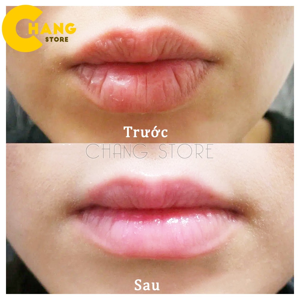 Mặt Nạ Ngủ Dưỡng Ẩm Môi Và Phục Hồi Môi Thâm | BigBuy360 - bigbuy360.vn