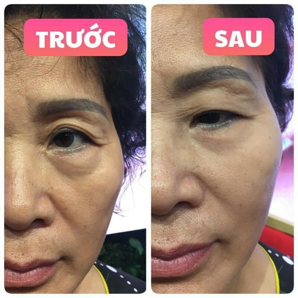 Kem Tan Bọng Mắt ⚜️FREESHIP⚜️ Kem Xóa Nhăn Ageless Hiệu Quả Bán Lẻ