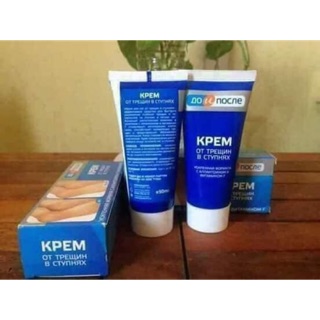 Kem trị nứt gót chân Kpem Nga