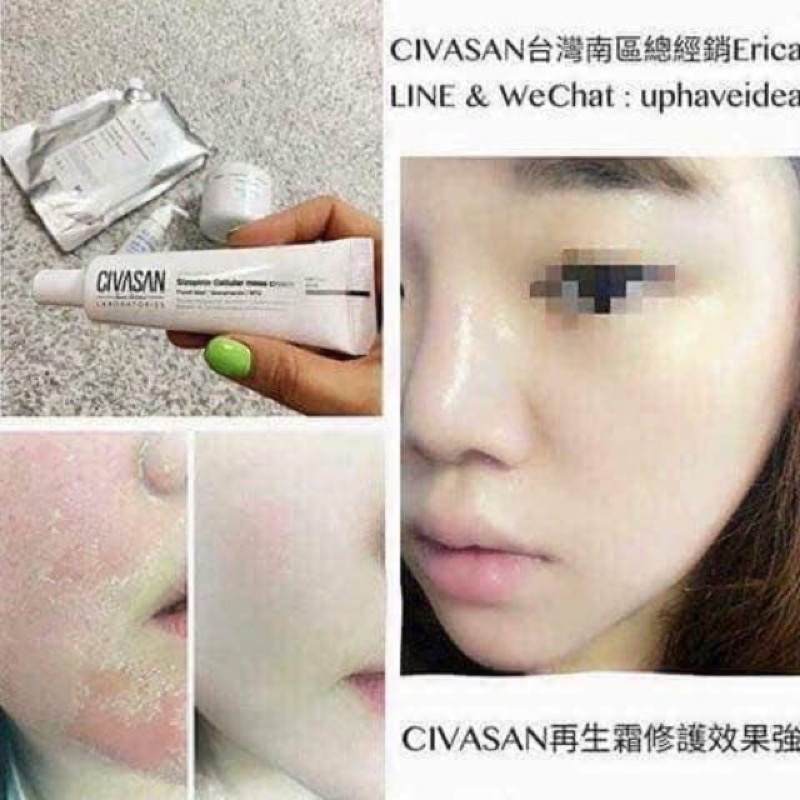 Kem Mess Civasan Tái Sinh Thần Tốc Cho Da Mỏng Yếu Nhạy Cảm 10ml - 35ml