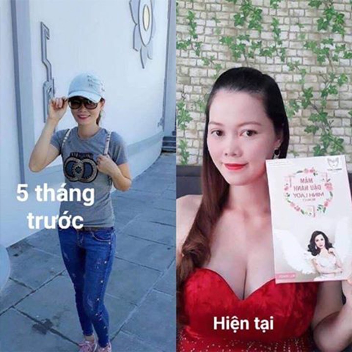 COMBO 5 Hộp Mầm Đậu Nành Minh Lady Tăng Vòng 1 An Toàn, Tặng 4 quà tặng,Cam Kết Hiệu Quả | BigBuy360 - bigbuy360.vn