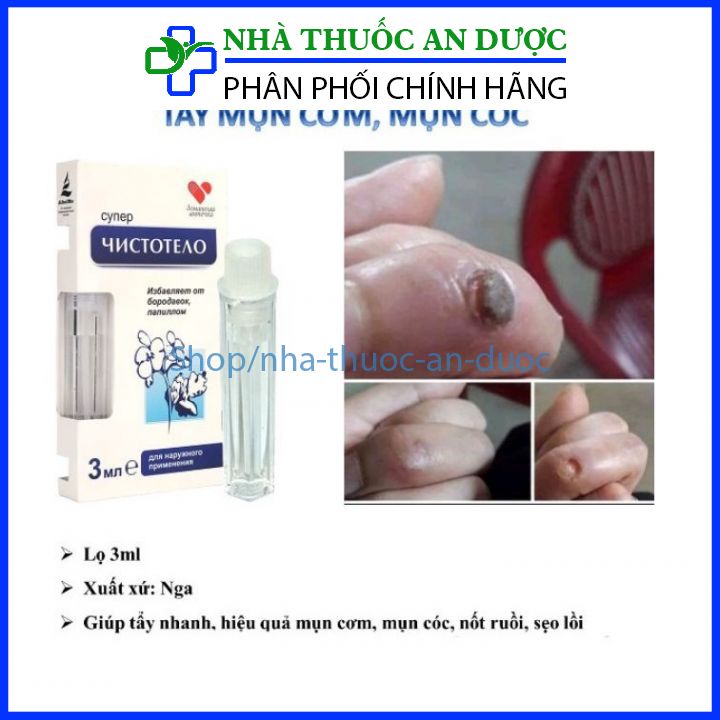 Chấm mụn cóc, mụn ruồi, mụn thịt thừa, sẹo lồi hàng chuẩn Nga – Gel Dvelinil – Lọ 3ml