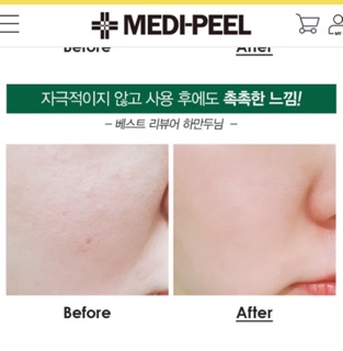 Mặt nạ thảo dược MEDIPEEL 𝐇𝐞𝐫𝐛𝐚𝐥 𝐏𝐞𝐞𝐥 𝐓𝐨𝐱 𝐖𝐚𝐬𝐡 𝐎𝐟𝐟 𝐓𝐲𝐩𝐞 𝐂𝐫𝐞𝐚𝐦 𝐌𝐚𝐬𝐤