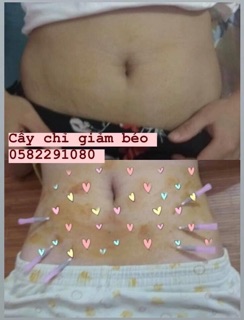 CHỈ GIẢM BÉO