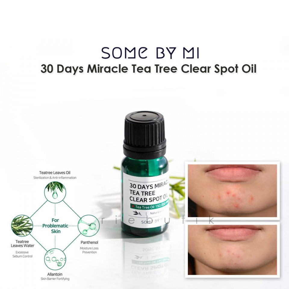 Tinh Dầu Tràm Trà Some By Mi 30 Days Miracle Clear Spot Oil 10ml