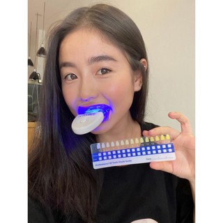 Bộ kit làm trắng răng tại nhà MAGIC SMILE nhập khẩu, tiêu chuẩn Châu Âu, hiệu quả, tiện lợi - Shop Tiện Ích Vượt Trội