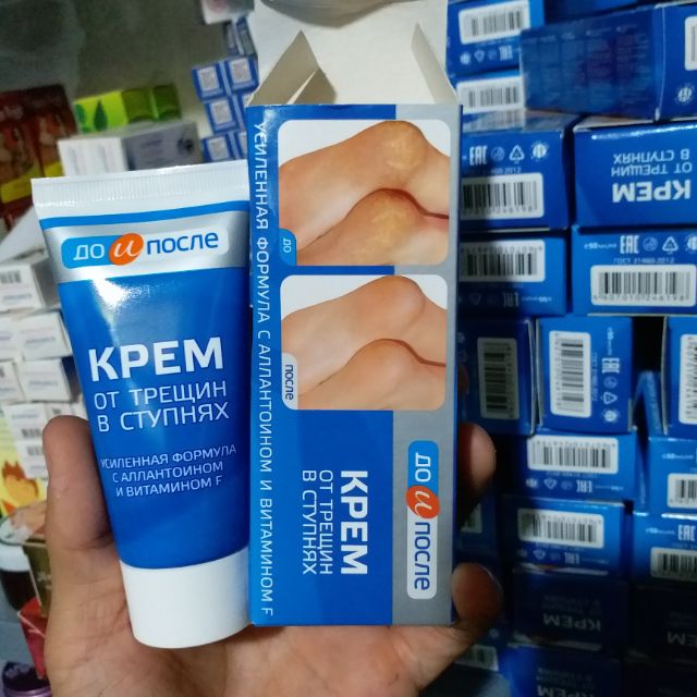 Kem nứt gót chân Nga ( hàng chuẩn)