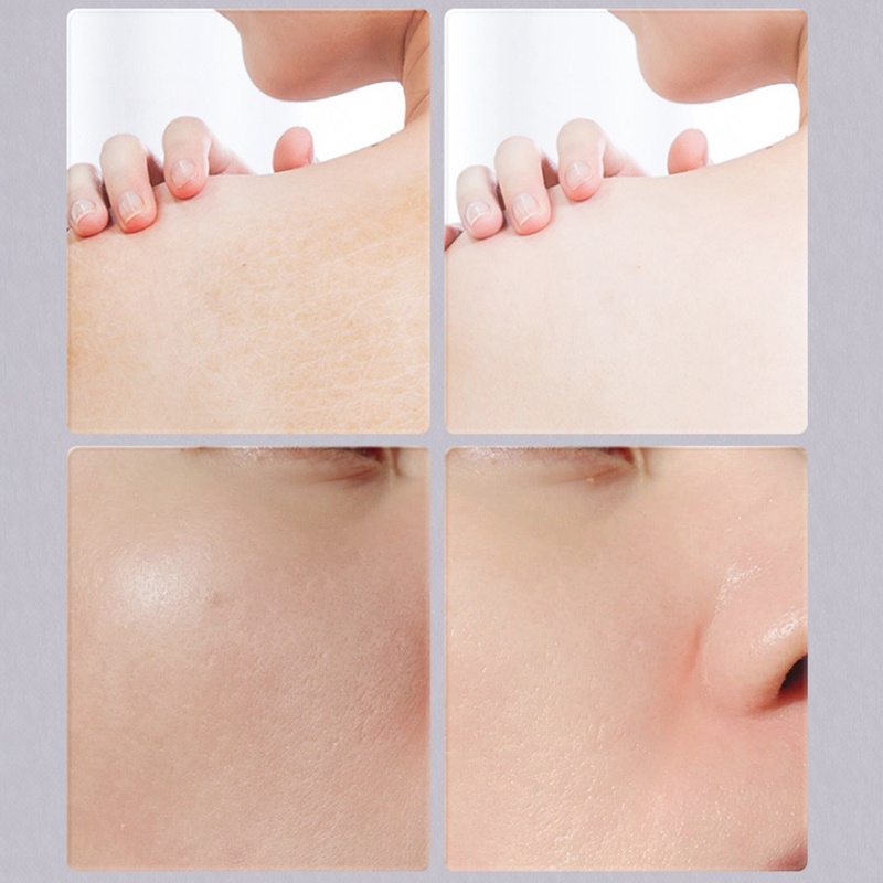 Kem Dưỡng Ẩm Đa Năng Giúp Làm Sáng Da Và Chống Nếp Nhăn YOUYO