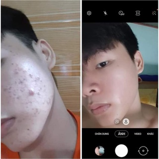 Serum thảo dược tái tạo NGỌC LINH SÂM