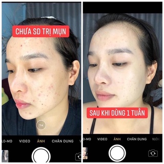 CAO MỤN SÂM ĐỎ