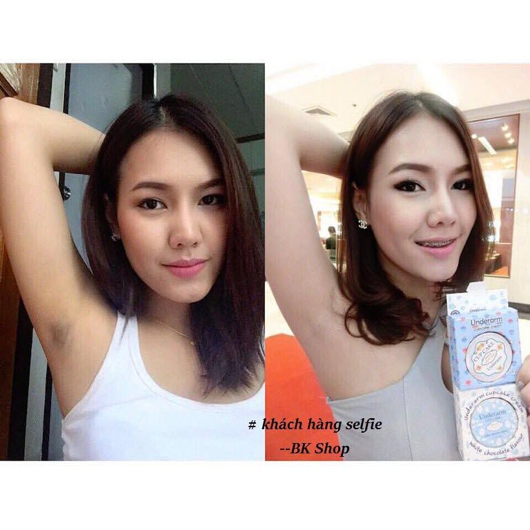 [ Date 06 - 2022 ] Kem hỗ trợ giảm thâm nách, vùng bẹn Underarm Cupcake Cream New