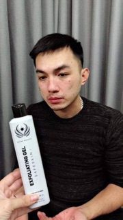 Tẩy tế bào chết shine beauty