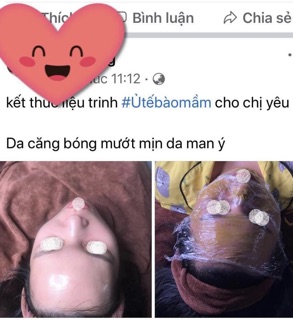 Mầm phôi thai tái sinh (mẫu mới 2024)