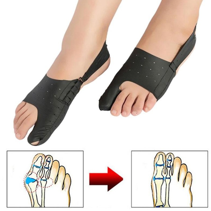 Dụng Cụ Nẹp Chỉnh Hình Ngón Chân Cái Chăm Sóc Giảm Đau