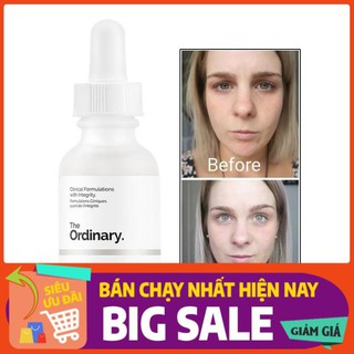 Salevigo2 [RẺ NHẤT SHOPEE] Tinh Chất Trị Mụn Làm Sáng Da The Ordinary Niacinamide 10% + Zinc 1% Serum 30ml