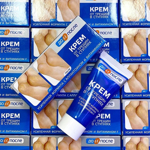 Kem nứt gót chân nga Kpem foot cream 50ml