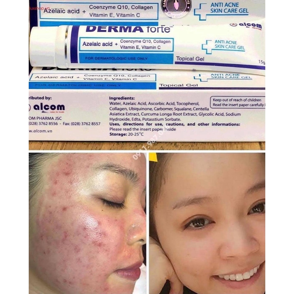 Kem dưỡng giảm mụn mờ thâm DERMA FORTE