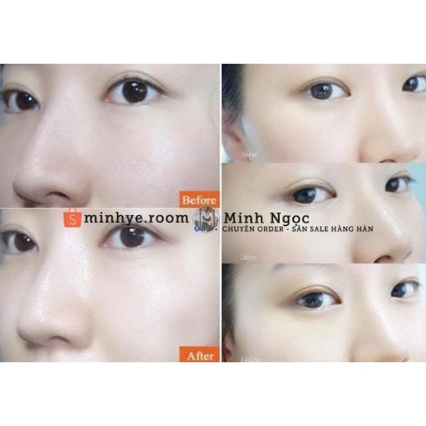 Bột Collagen Uống Lựu Đỏ Bio Cell Hàn Quốc Thần Dược Đẹp Da Giảm Cân Thải Độc Tố Mờ Nám | Thế Giới Skin Care